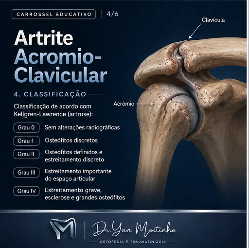 Classificação Clínica de Kellgren-Lawrence